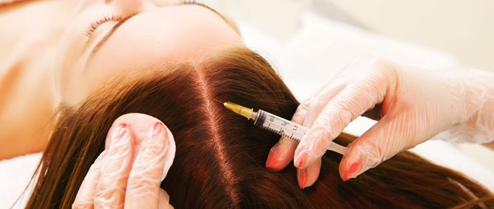 اهمیت خرید بهترین مارک داروی مزوتراپی مو چیست؟