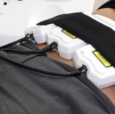 laser lipolysis